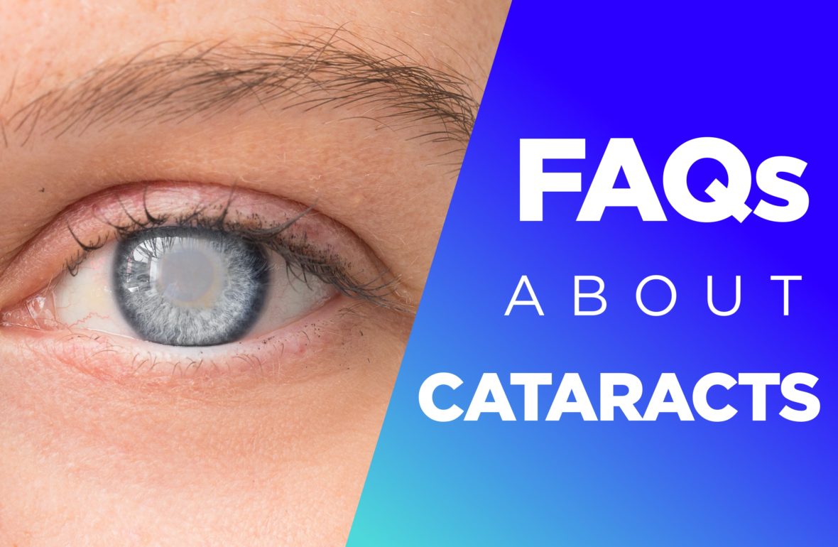 The Effects of Cataracts 10 FAQs EZOnTheEyes