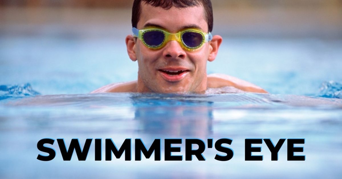 How to Prevent Swimmer's Eye Infection in the Pool EZOnTheEyes