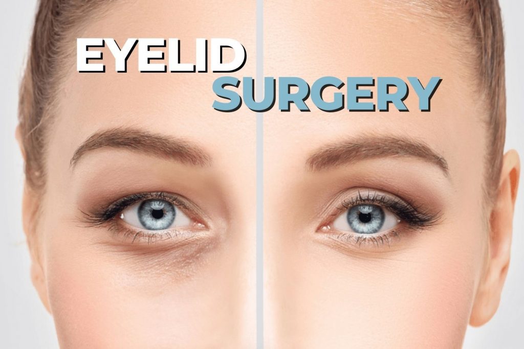 eyelid surgery