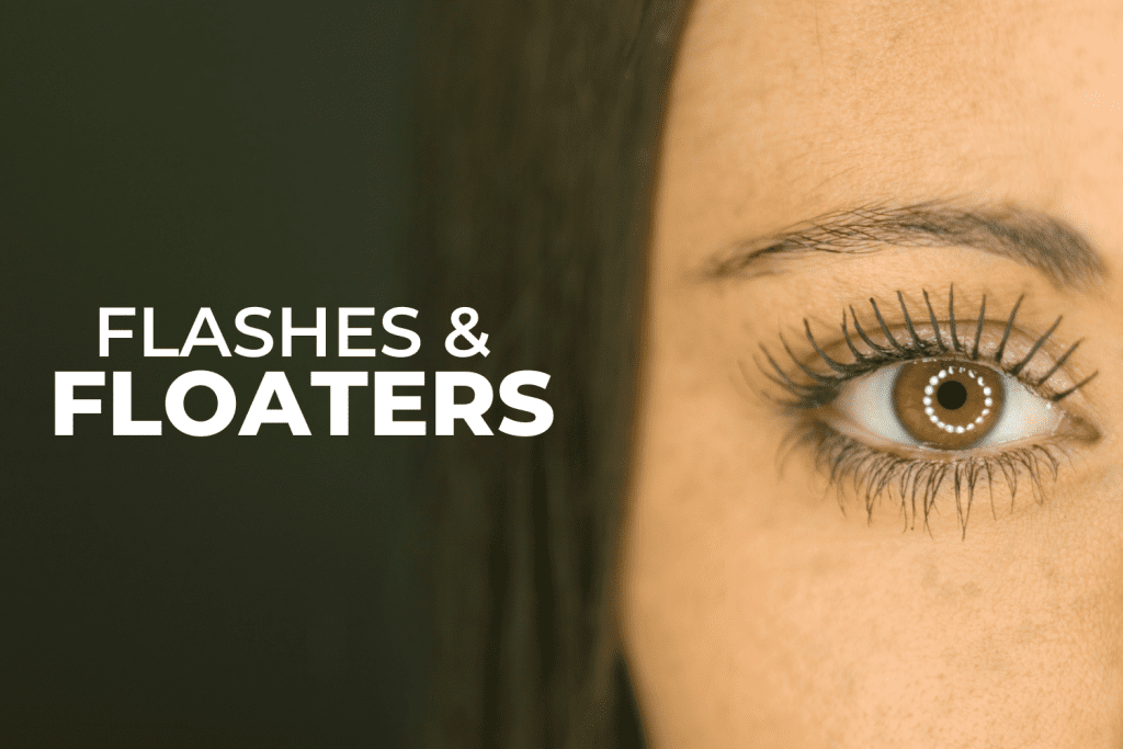 flashes and floaters