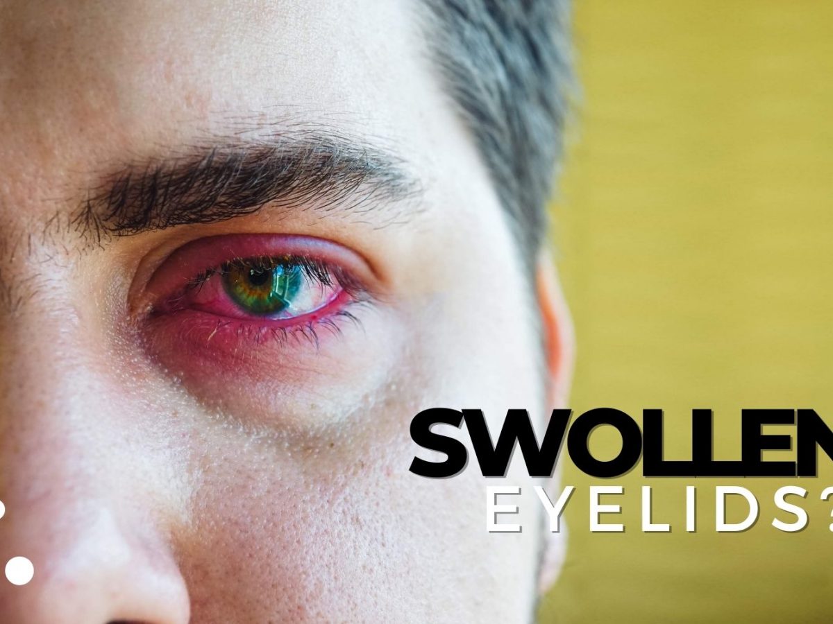 The Many Causes Of Swollen Eyelids