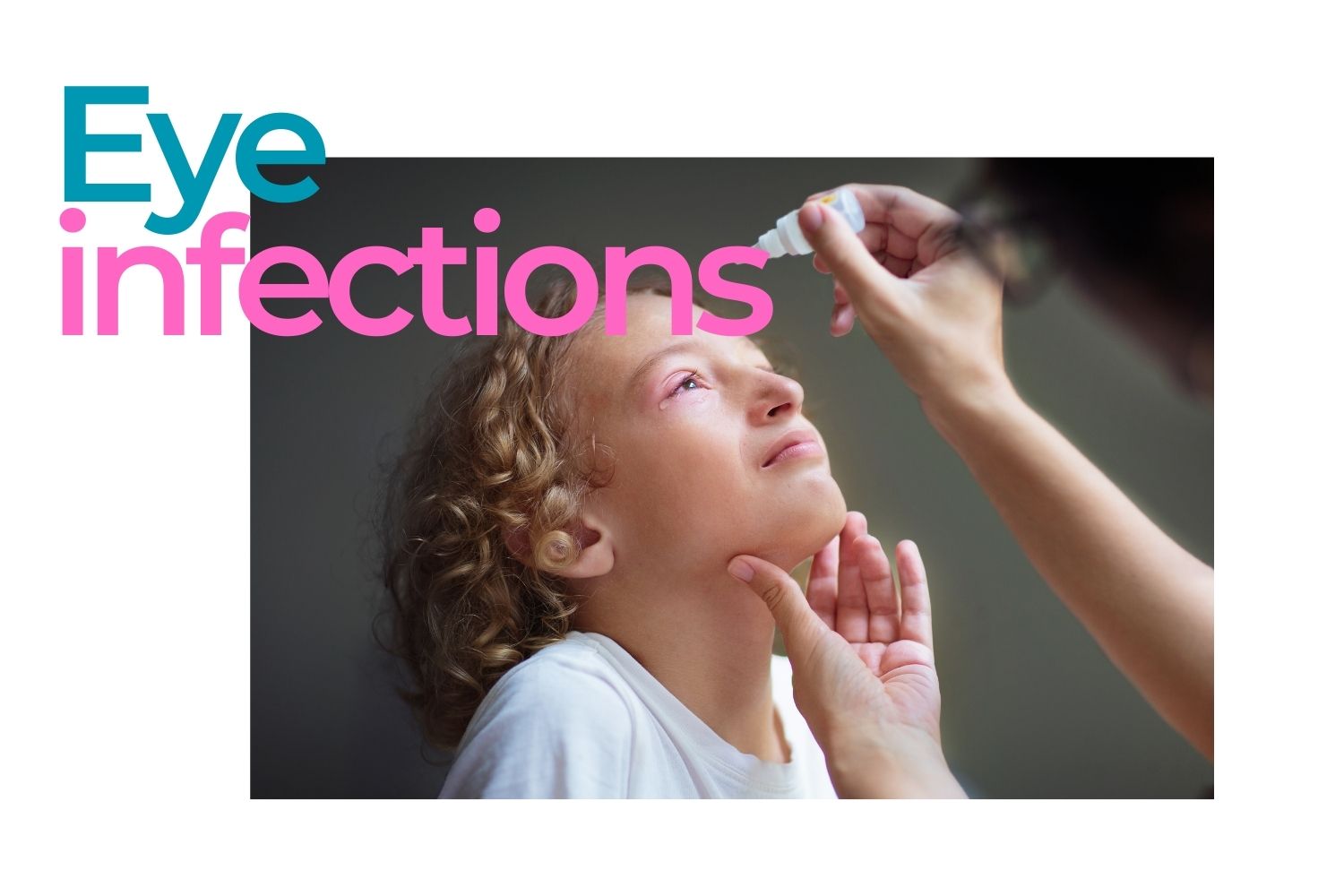 Understanding Eye Infections Are Eye Colds the Same as Pink Eye? EZOnTheEyes