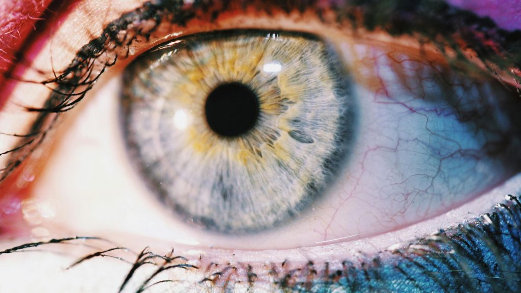 Close-up of a red, irritated eye