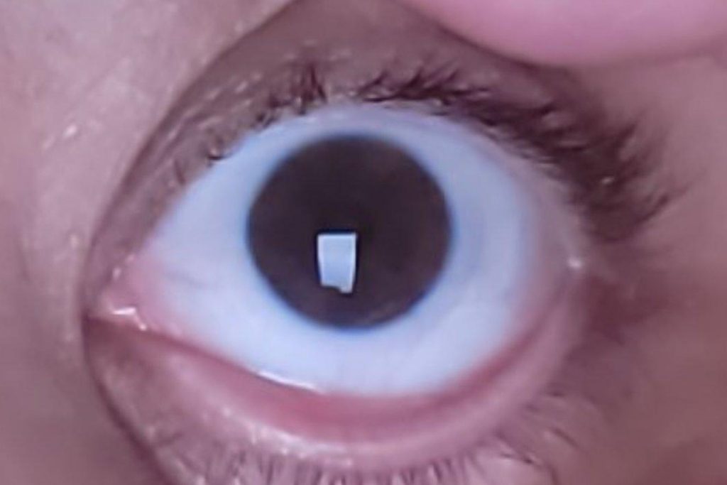 Close-up of woman's eye with contact