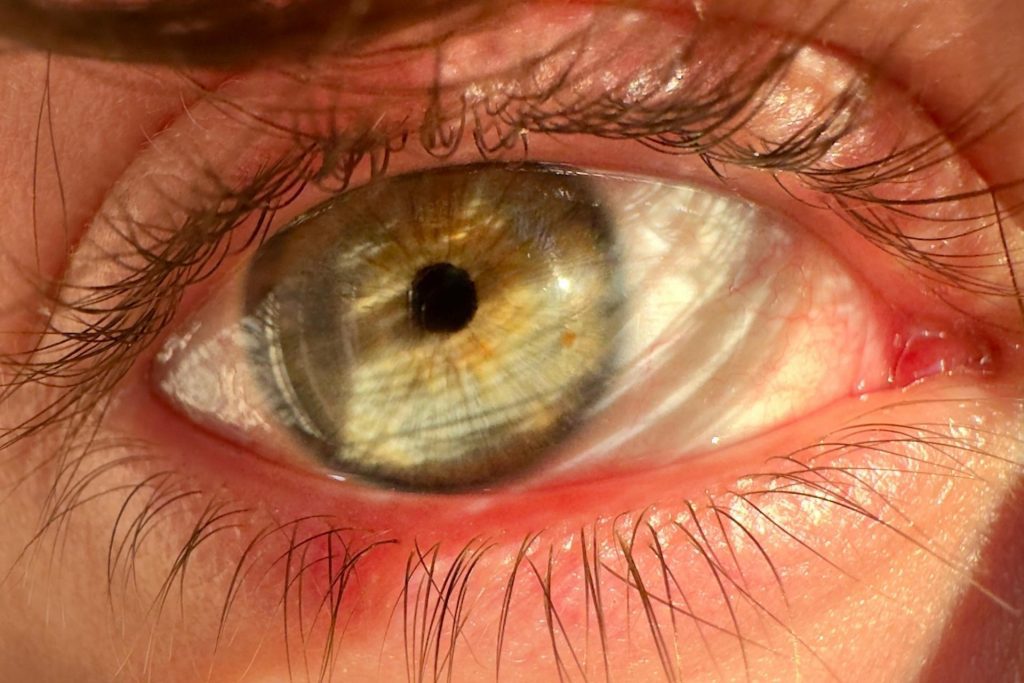 Close-up of hazel-green eye