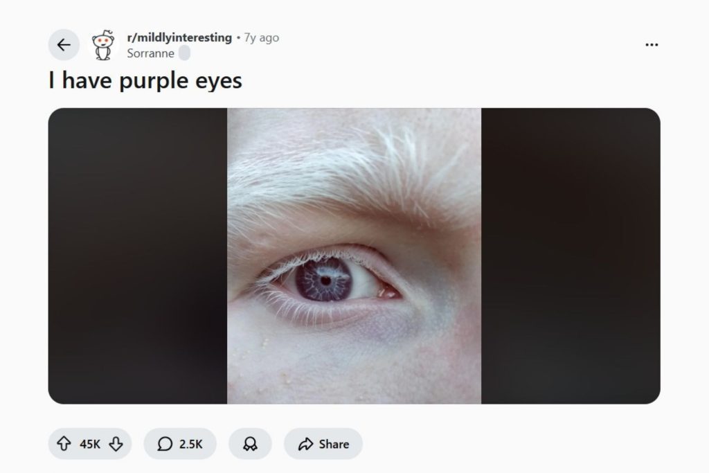 Reddit screenshot of man with purple eyes