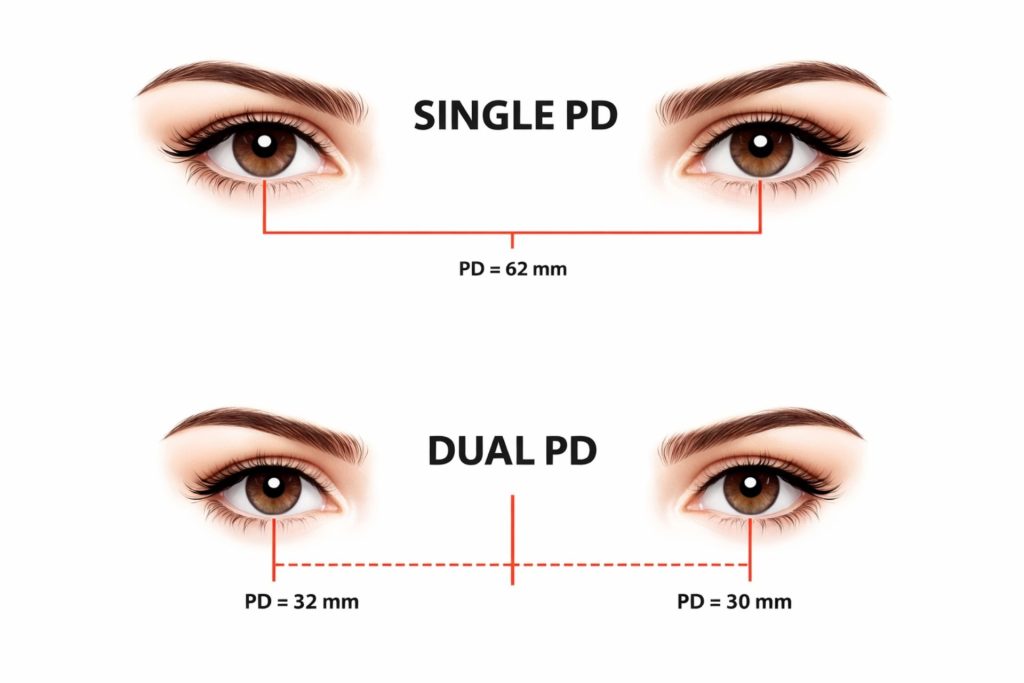 Single PD and dual PD examples