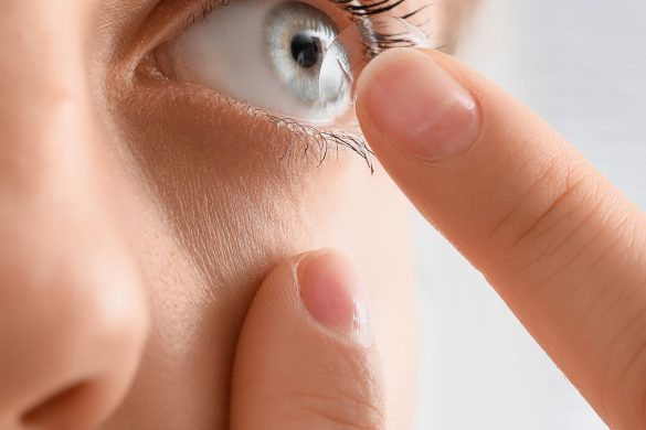 Extended-Wear Contacts: Top Benefits & Downsides