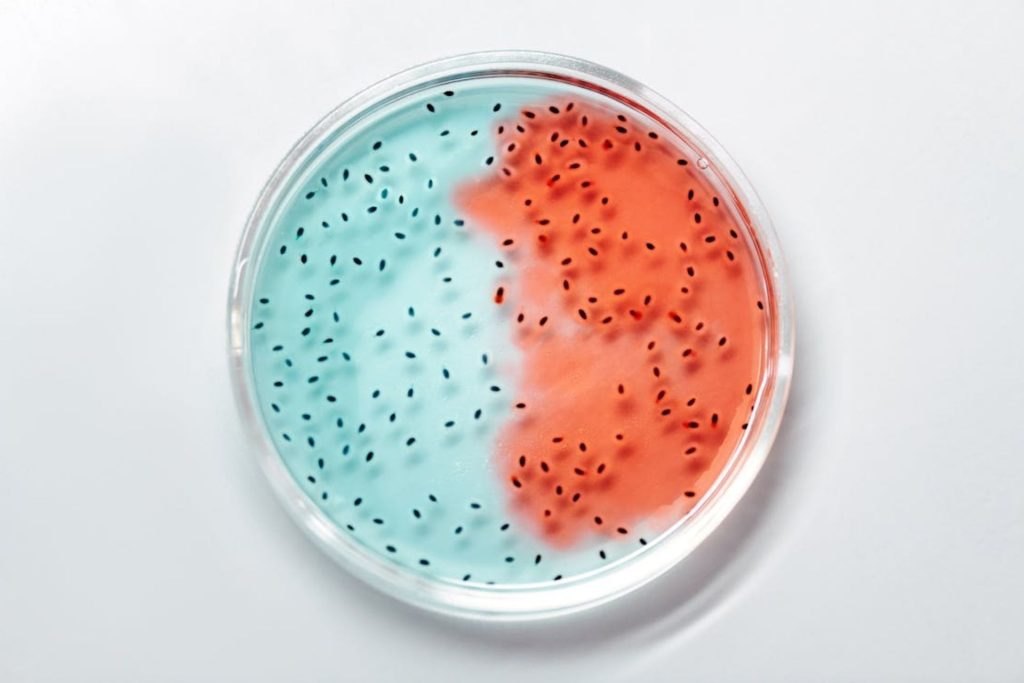 A petri dish filled with bacteria