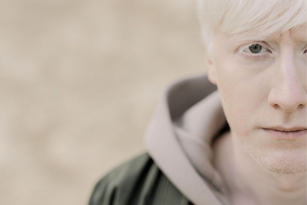 Man with albinism in gray hoodies
