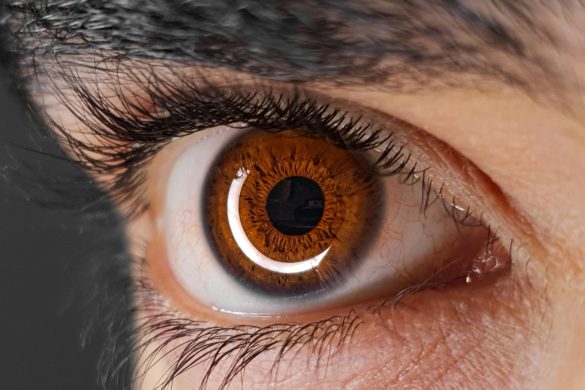 What Does 20/25 Vision Mean?