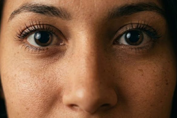 How Long Does Eye Dilation Last?