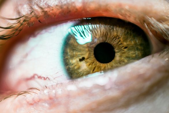 How To Get Something Out of Your Eye: Top Tips To Try