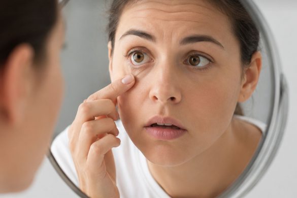 Contact Lens Stuck in Eye: What To Do (and What Not To Do)