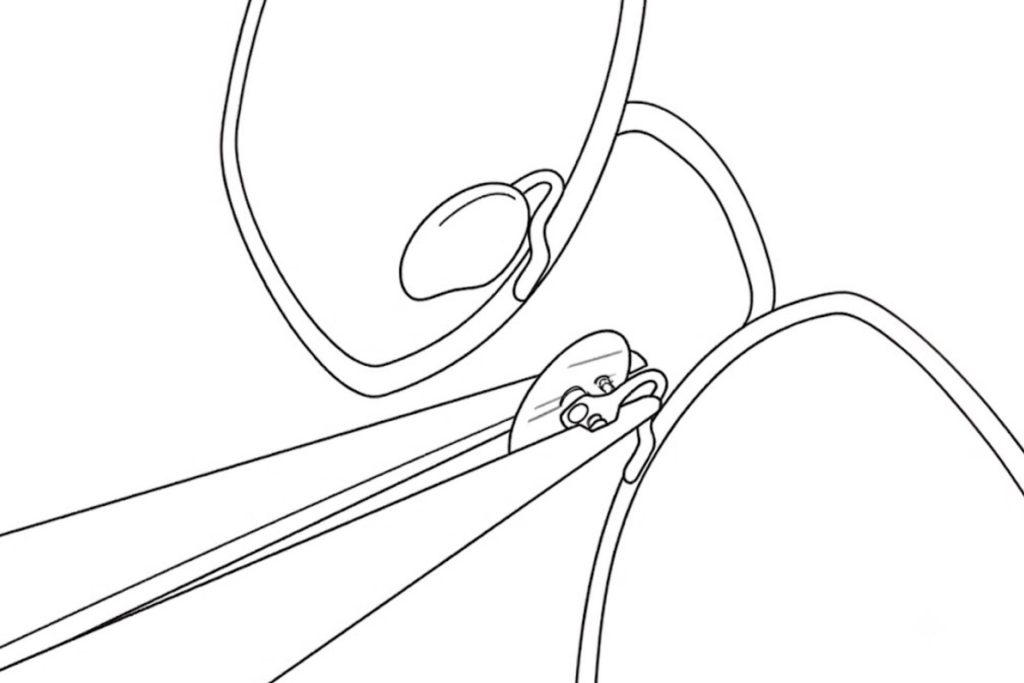 Diagram of Nose Pads Being Adjusted
