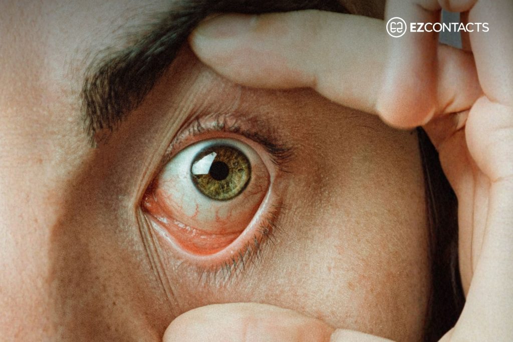 Person Holding Open Eye