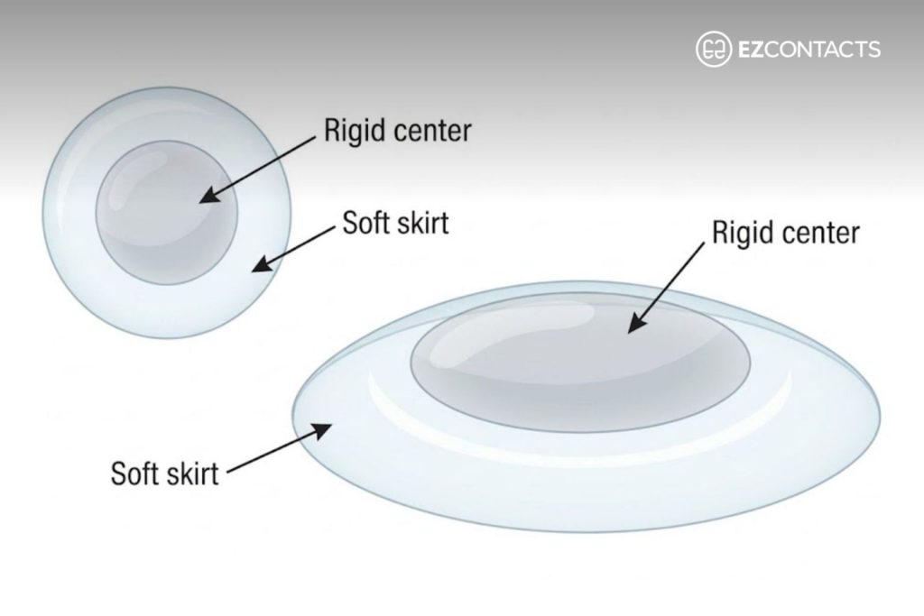 Illustration of a Hybrid Contact Lens