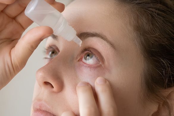 Eye Drops for Scratched Cornea: Do They Work?